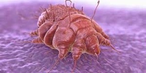 scabies 3